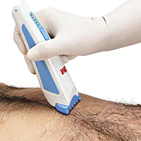 Tek kullanımlık clipper ile tüy temizliği